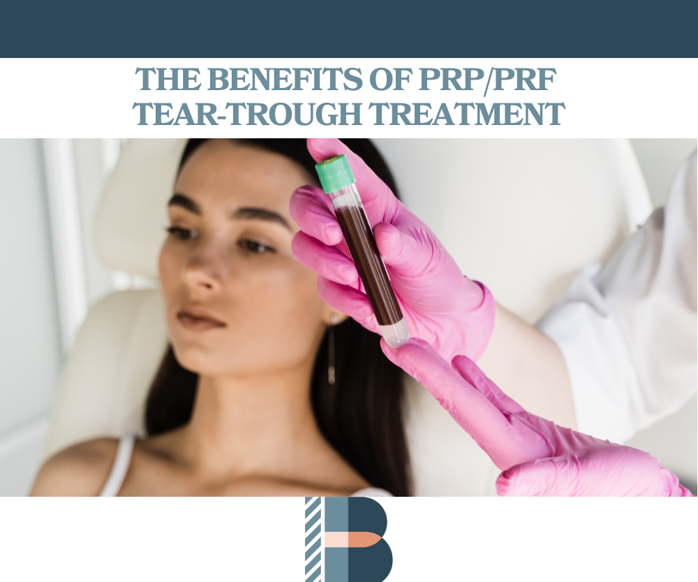 The Benefits of PRPPRF Tear-Trough Treatment